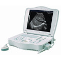 PT3000e1 Full Digital Ultrasound Scanner